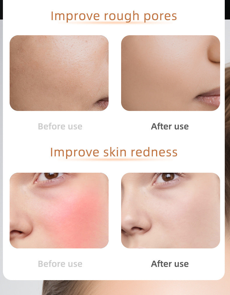 Beauty Instruments LED Facial Mask